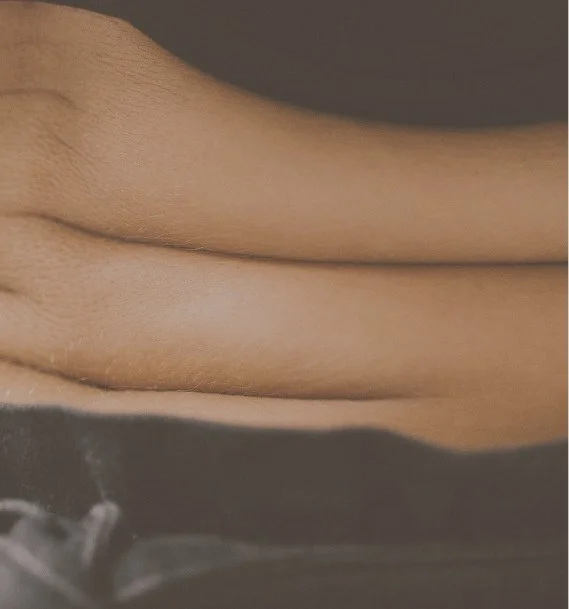Localized areas of loose skin