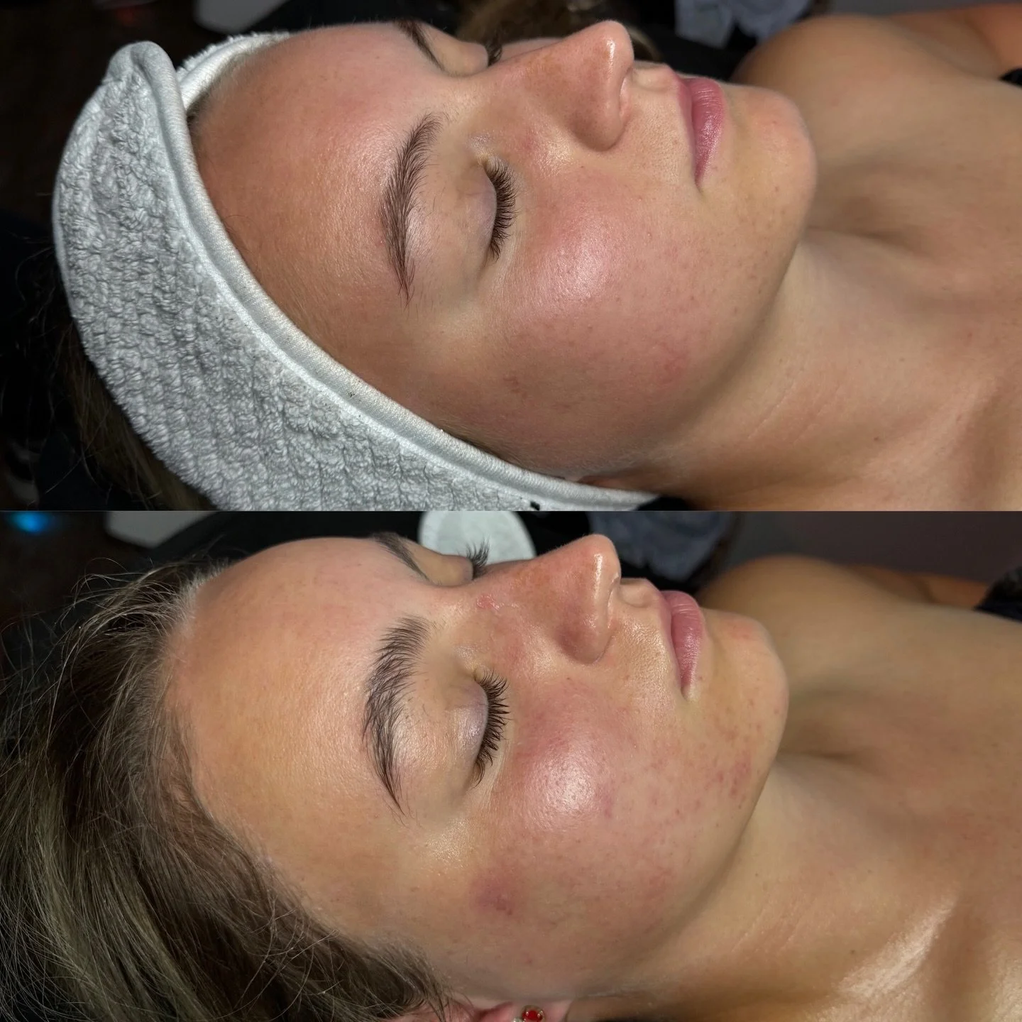 ⠀⠀⠀⠀⠀⠀⠀⠀⠀
𝕾𝖊𝖗𝖛𝖎𝖈𝖊: Service: signature facial + dermaplane 
.
𝕬𝖗𝖙𝖎𝖘𝖙: @kbbrows
.
𝕾𝖈𝖍𝖊𝖉𝖚𝖑𝖎𝖓𝖌: 𝖈𝖆𝖑𝖑 𝖔𝖗 𝖙𝖊𝖝𝖙 614.230.2589
.
⠀⠀⠀⠀⠀⠀⠀⠀⠀
.
⠀⠀⠀⠀⠀⠀⠀⠀⠀
.
⠀⠀⠀⠀⠀⠀⠀⠀⠀
.
⠀⠀⠀⠀⠀⠀⠀⠀⠀
. 
#614 #columbusohio #columbus #ohio #osu