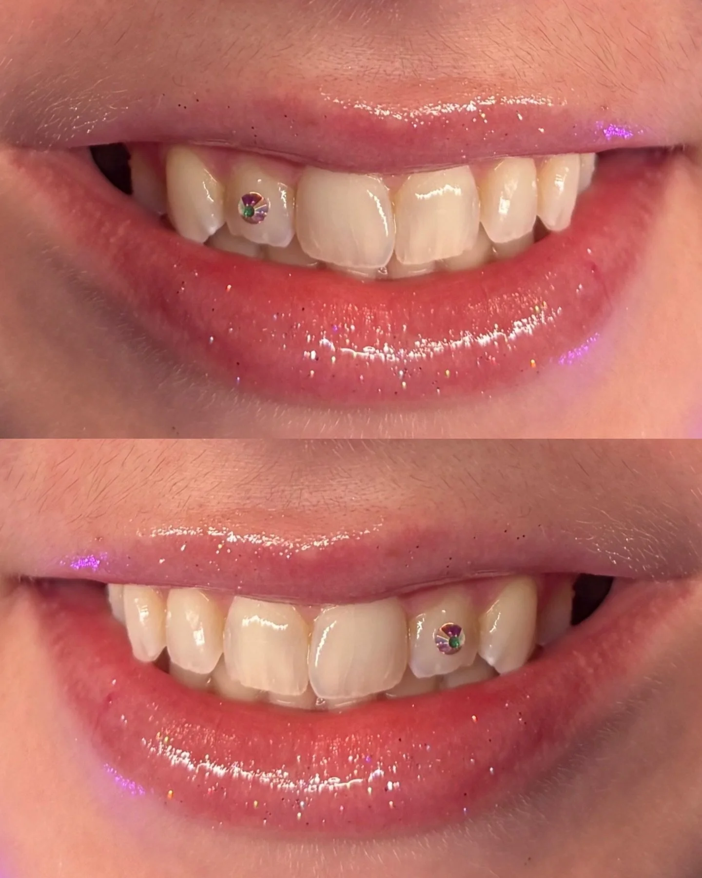 𝕾𝖊𝖗𝖛𝖎𝖈𝖊: Level 1 Tooth Gem
.
𝕬𝖗𝖙𝖎𝖘𝖙: @babyfacebyblake
.
𝕾𝖈𝖍𝖊𝖉𝖚𝖑𝖎𝖓𝖌: 𝖈𝖆𝖑𝖑 𝖔𝖗 𝖙𝖊𝖝𝖙 614.230.2589
.
⠀⠀⠀⠀⠀⠀⠀⠀⠀
.
⠀⠀⠀⠀⠀⠀⠀⠀⠀
.
⠀⠀⠀⠀⠀⠀⠀⠀⠀
.
⠀⠀⠀⠀⠀⠀⠀⠀⠀
. #toothgems #columbusskin #columbustoothgems #columbusbeauty #asseenincolu
