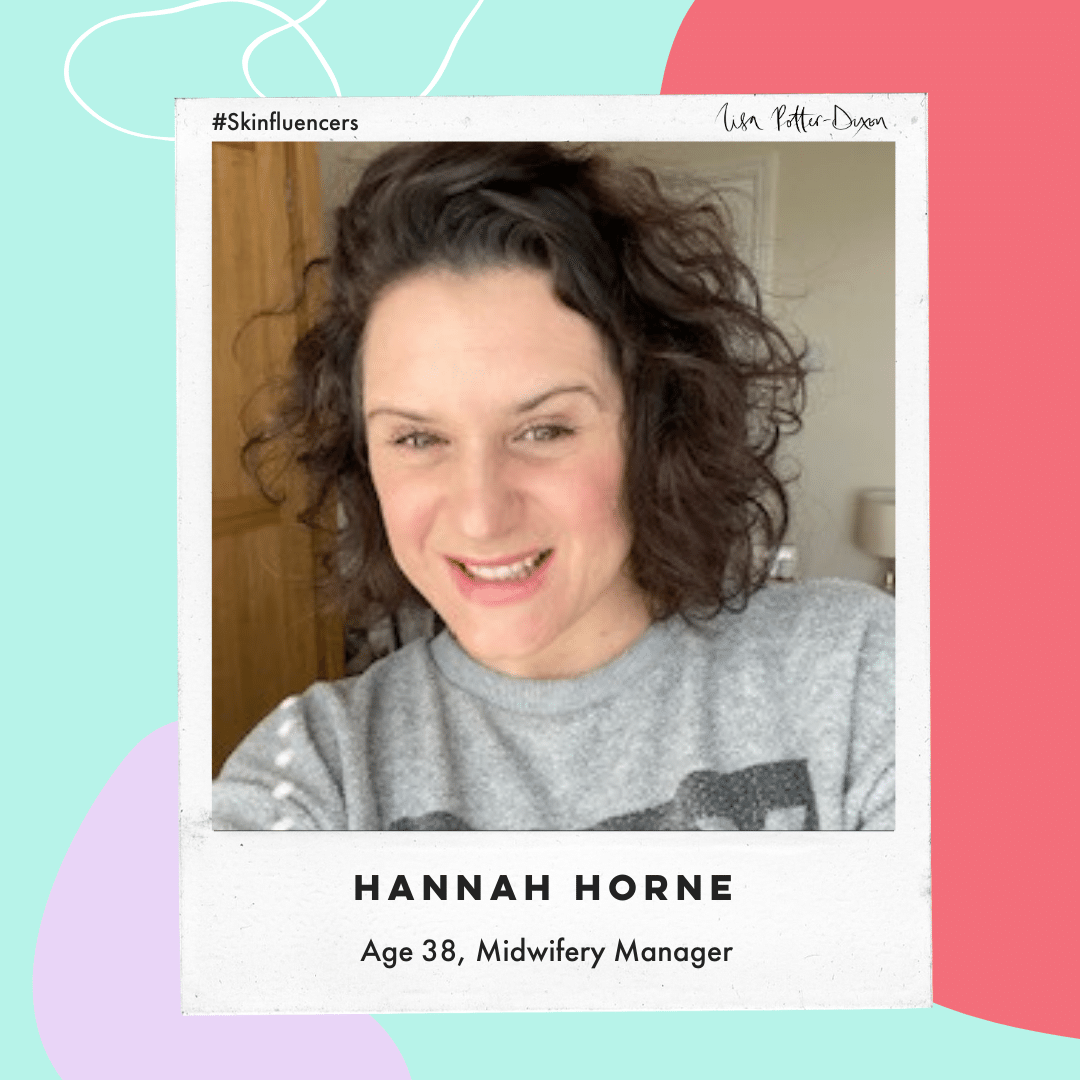 Lisa Potter-Dixon - Skinfluencers - Hannah Horne.png