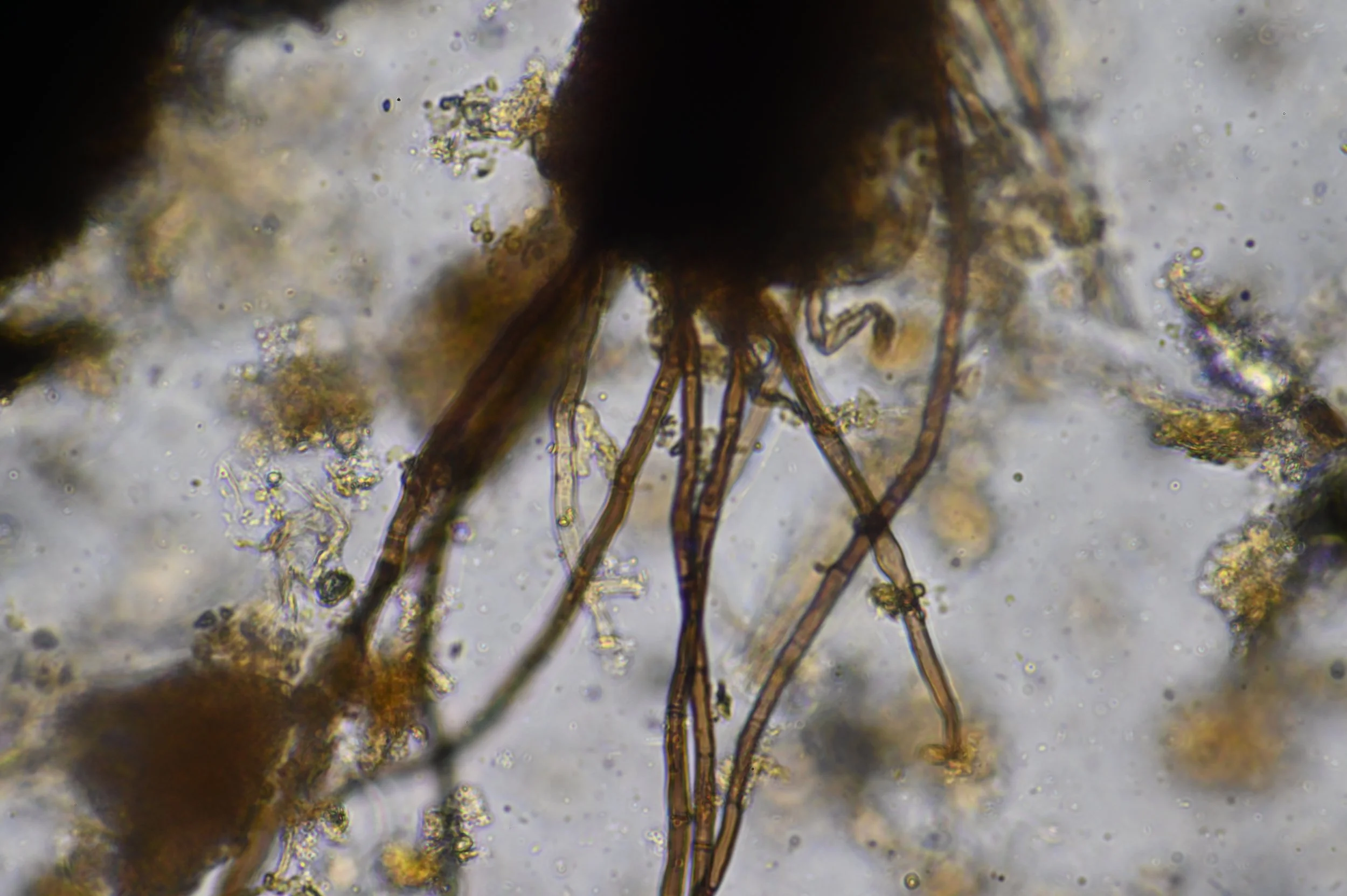 Micrograph of Kres Farm soil taken at 400x TM showing bacteria, fungal hyphae and a range of fulvic and humic acids.