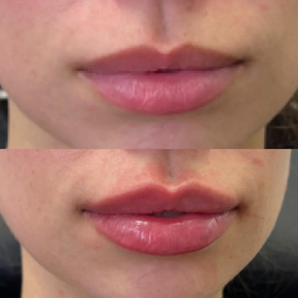 lips-before-after.jpg