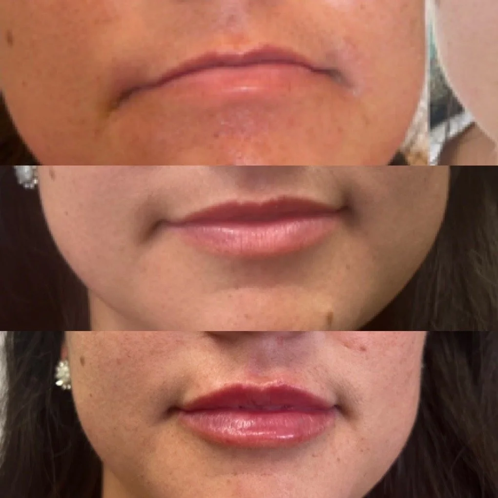 04-lips-before-after.JPG