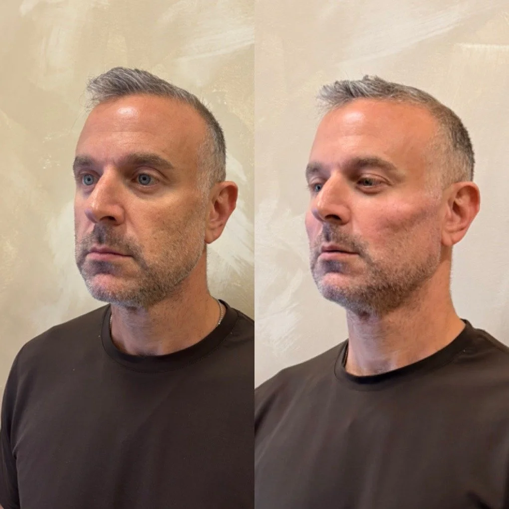 06-full-face-result.JPG