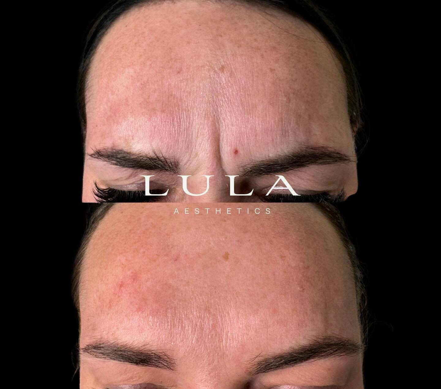 LULA AESTHETICS offers complementary consultations to discuss various anti-aging &amp; beauty concerns. 

RN Madi provides reassurance, knowledge &amp; honesty when it comes towards the medical procedures offered in clinic. 

It is necessary to speak