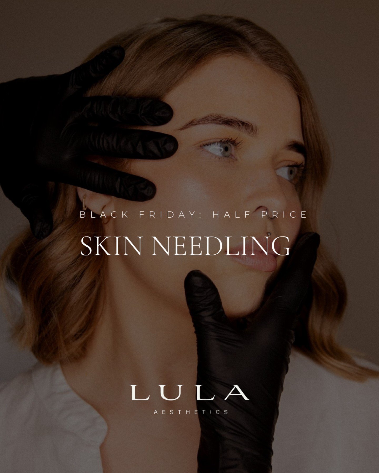 Black Friday Glow Alert! ✨ Skin Needling is now just $150 (was $300)!

Boost your collagen, refine your skin&rsquo;s texture, and enjoy a brighter, smoother complexion for half the price. Don&rsquo;t miss out on this one-day deal&mdash;perfect for ac