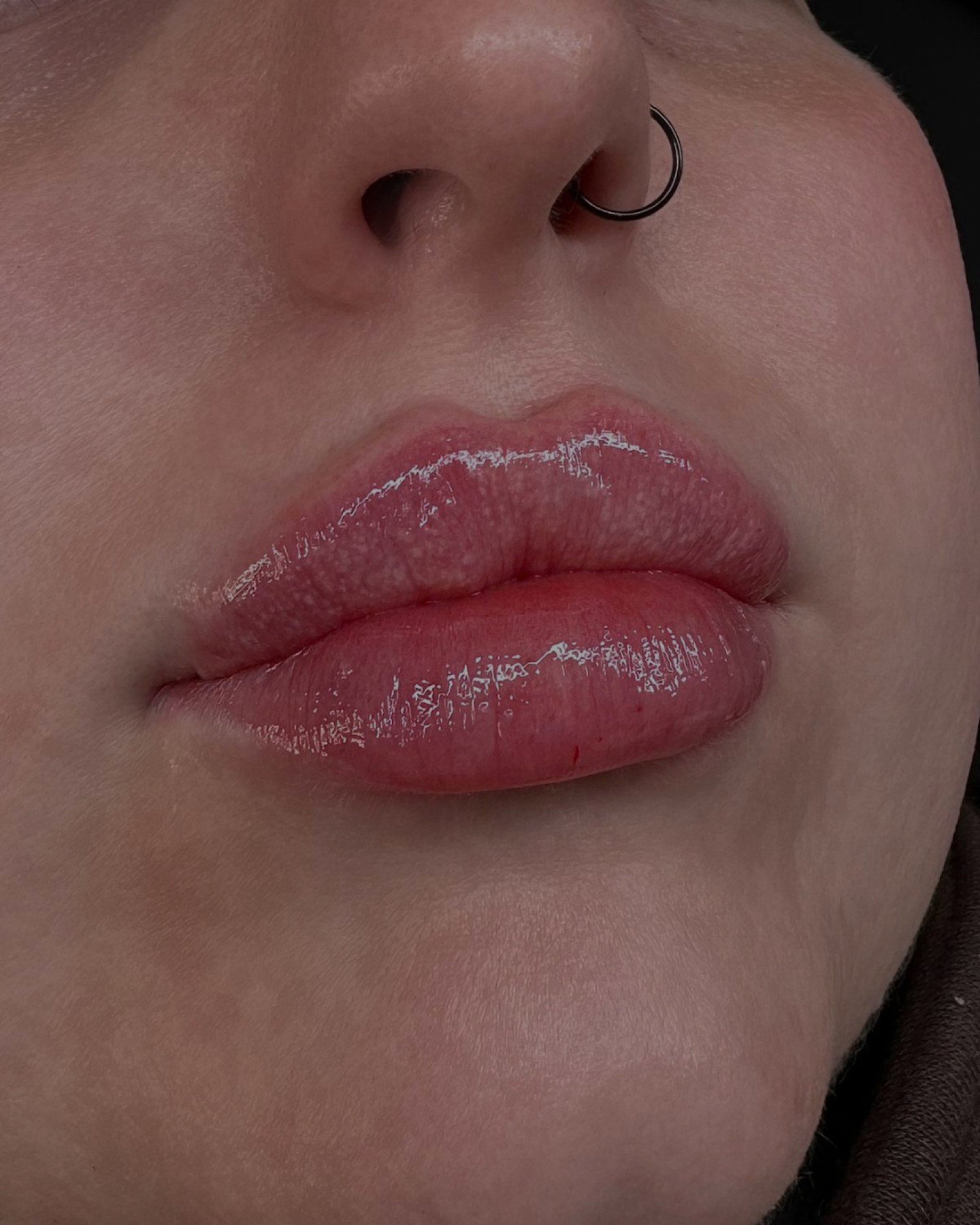 At Lula Aesthetics, we love working on the lips because they allow us to enhance natural symmetry, shape, and definition, creating a look that&rsquo;s uniquely you. Whether it&rsquo;s subtle hydration or a more defined contour, we offer consultations