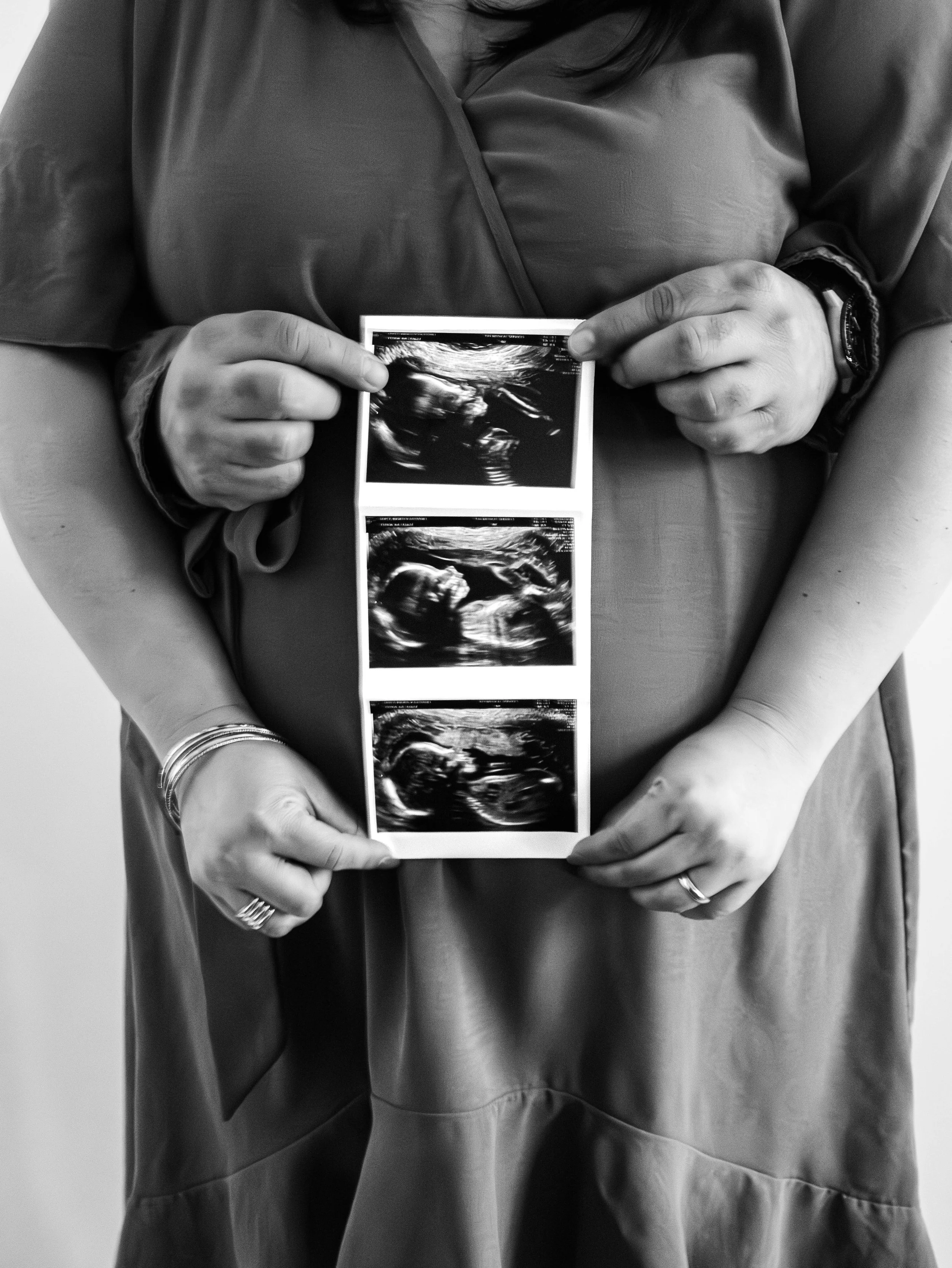 Person holding ultrasound images of a fetus against their stomach.