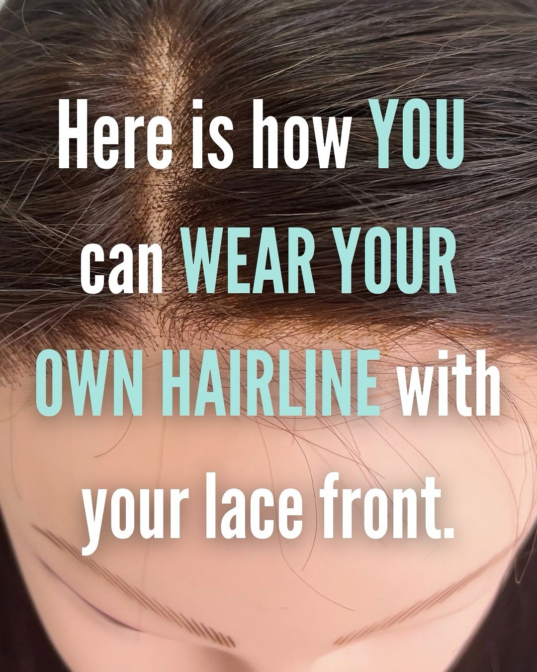 Struggling to blend your lace top wig or topper with your own bio hair in front? Girl, you are not alone&mdash;and you&rsquo;re definitely in the right place.

Whether it&rsquo;s from alopecia, trichotillomania, or years of tight ponytails doing you 