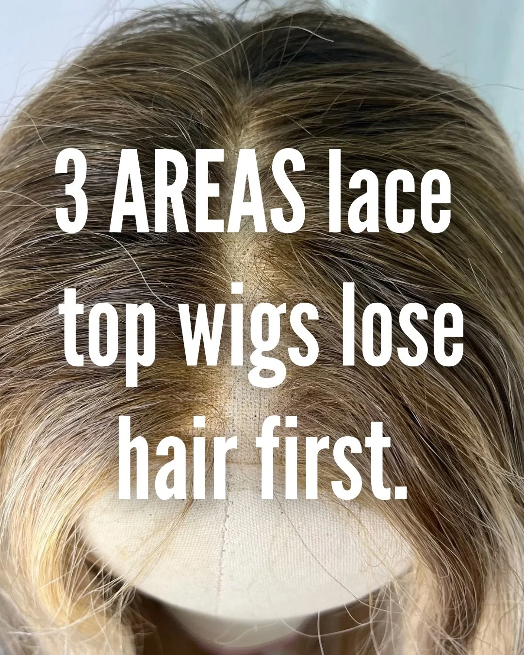 Hair loss in lace tops doesn&rsquo;t happen all at once. In lace top wigs &amp; toppers, thinning starts in specific areas first due to construction, knot size, and daily wear. 

The most common areas we see hair loss develop are the part, the front 