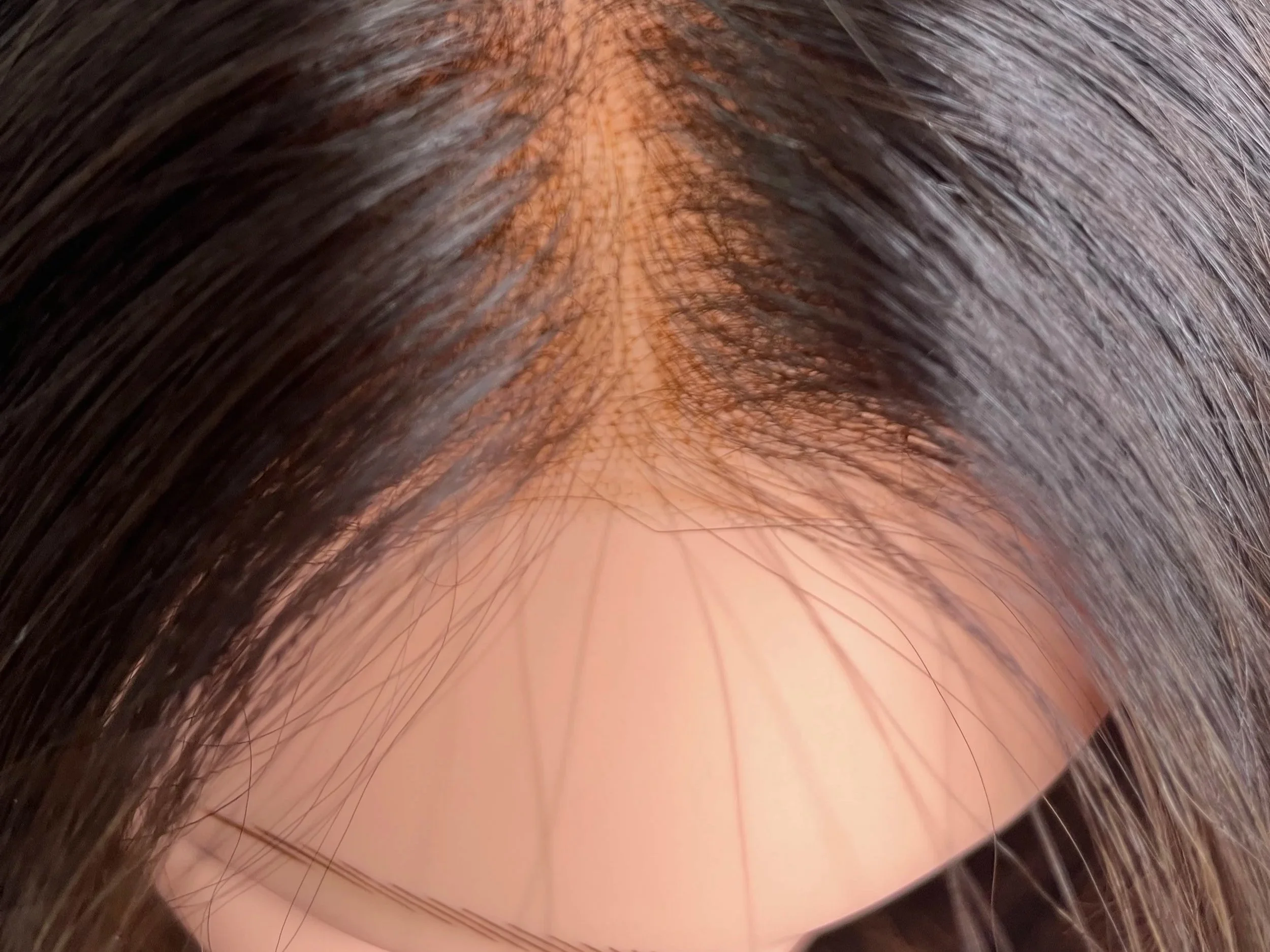 Close-up image of a person's scalp and dark brown hair.
