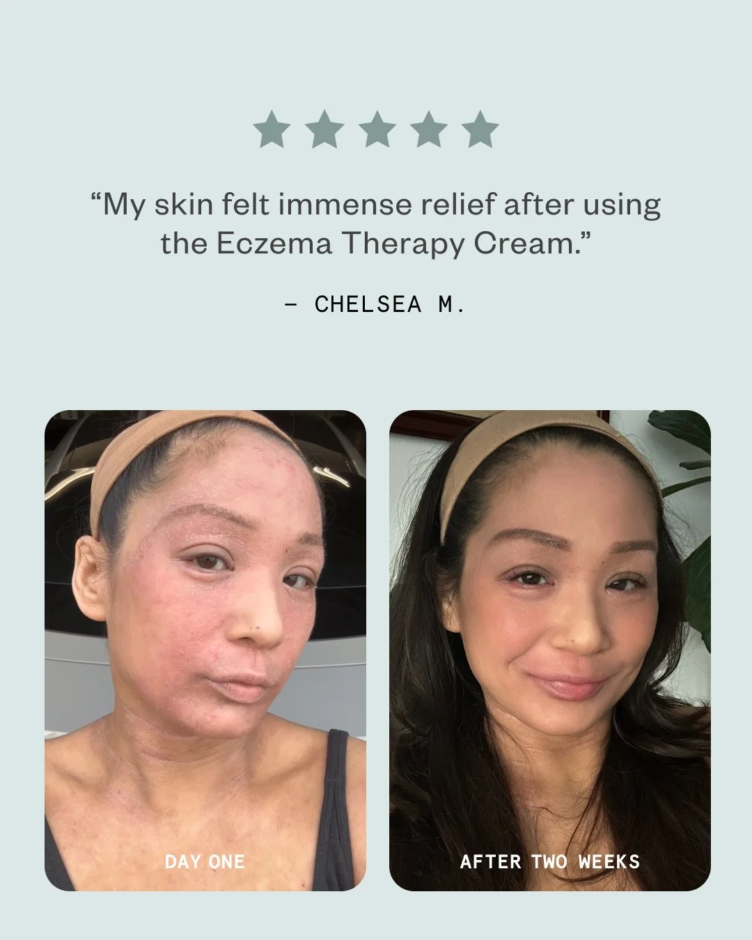 Chelsea_B&A_TherapyCream.jpg