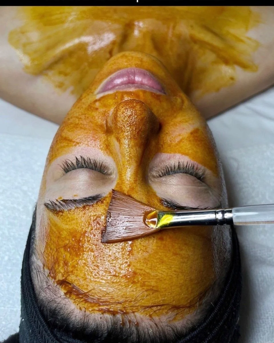 Clarifying and extracting acne medical protocol session