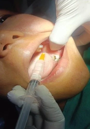 Care and Recovery: Amrita's Dental Treatment