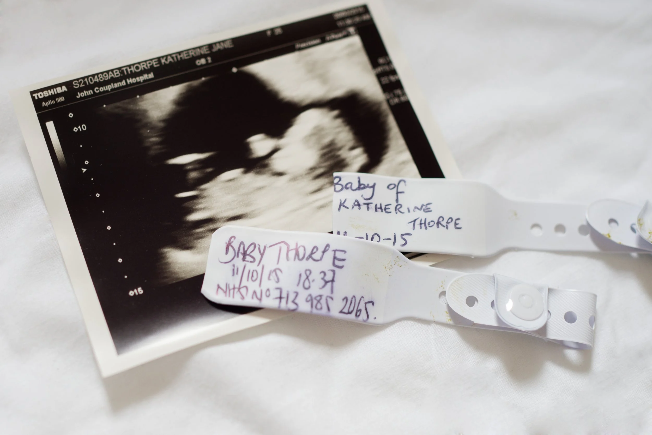 Ultrasound image of a fetus with handwritten tags indicating it is the baby of Katherine Thorpe, with a hospital name and date.