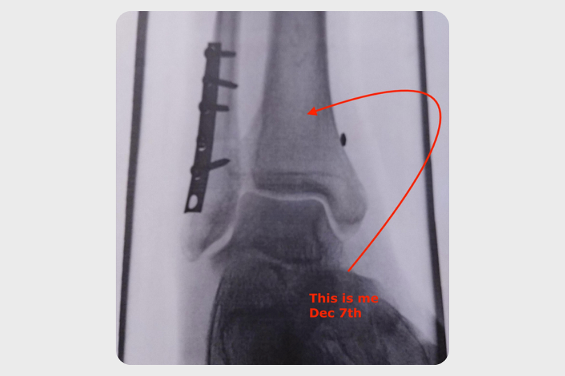 Data-Driven Recovery