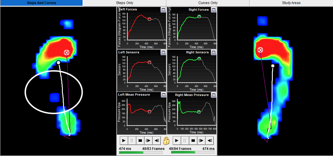 Plantar pressure palte image pronation