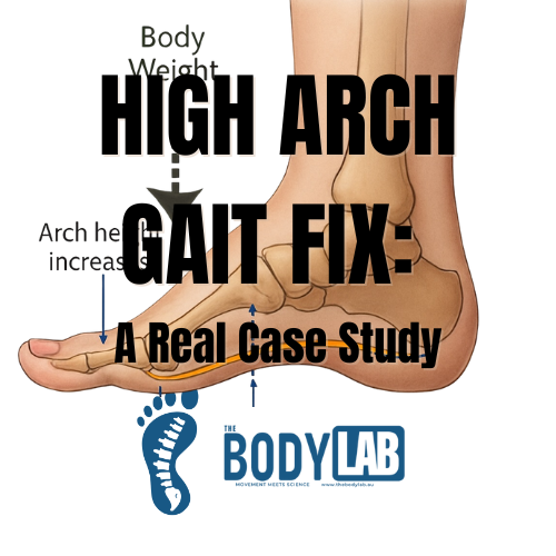 High Arches Causing You Trouble?