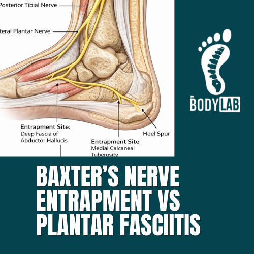 Baxter’s Nerve Entrapment vs Plantar Fasciitis