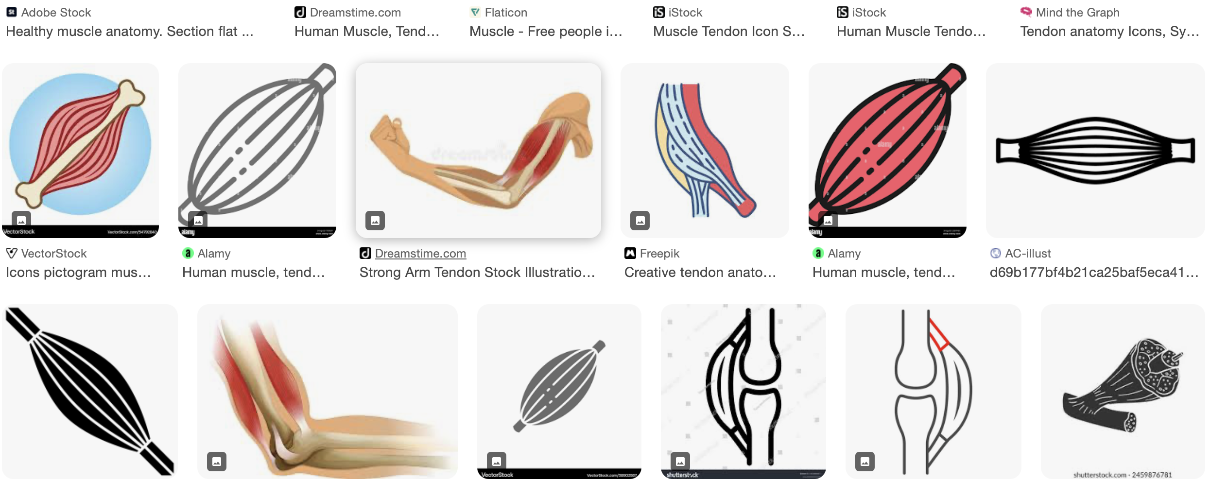 Muscle Builds Fast. Tendons Don’t Care About Your Two-Week Protein Challenge.