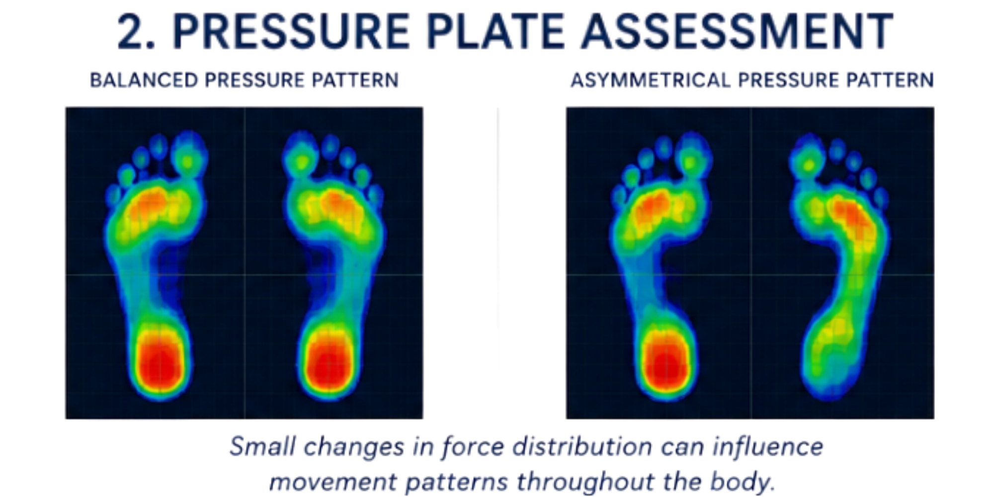 Comparison of pressure distribution patterns on feet: balanced pressure pattern on the left and asymmetrical pressure pattern on the right, with a note that small changes in force distribution can influence movement patterns throughout the body.