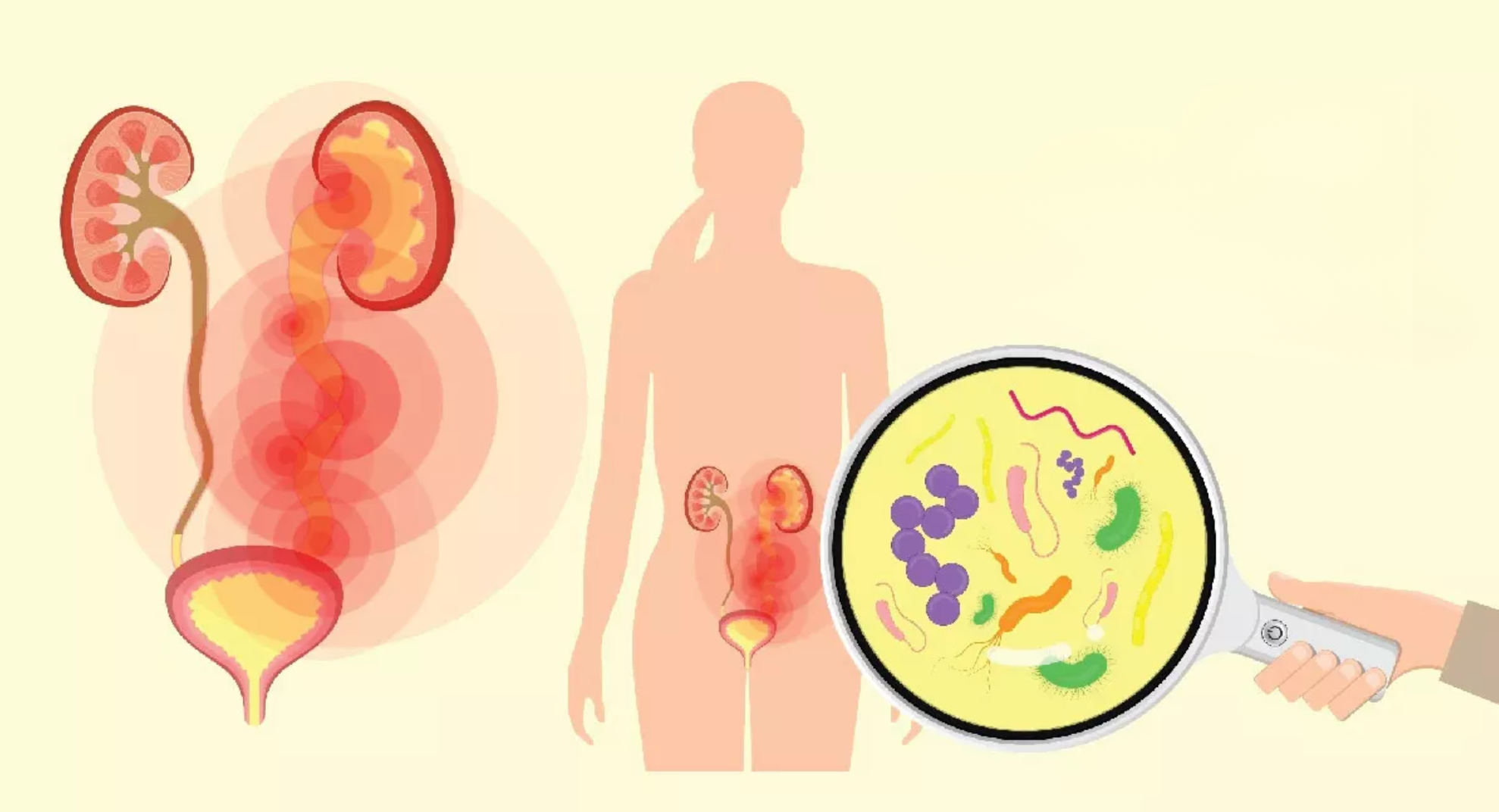 Holistic UTI Remedies