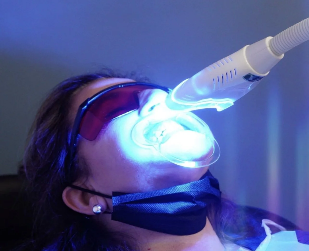 A female client receiving a teeth whitening treatment, laser machine honed in on her open mouth