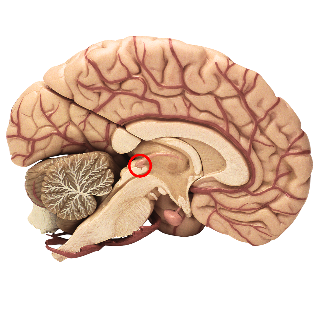 Calcified Pineal Gland(3).png