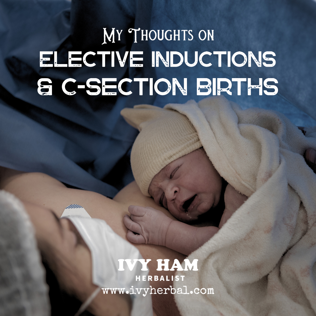 My Thoughts on Elective Inductions &amp; C-Section Births