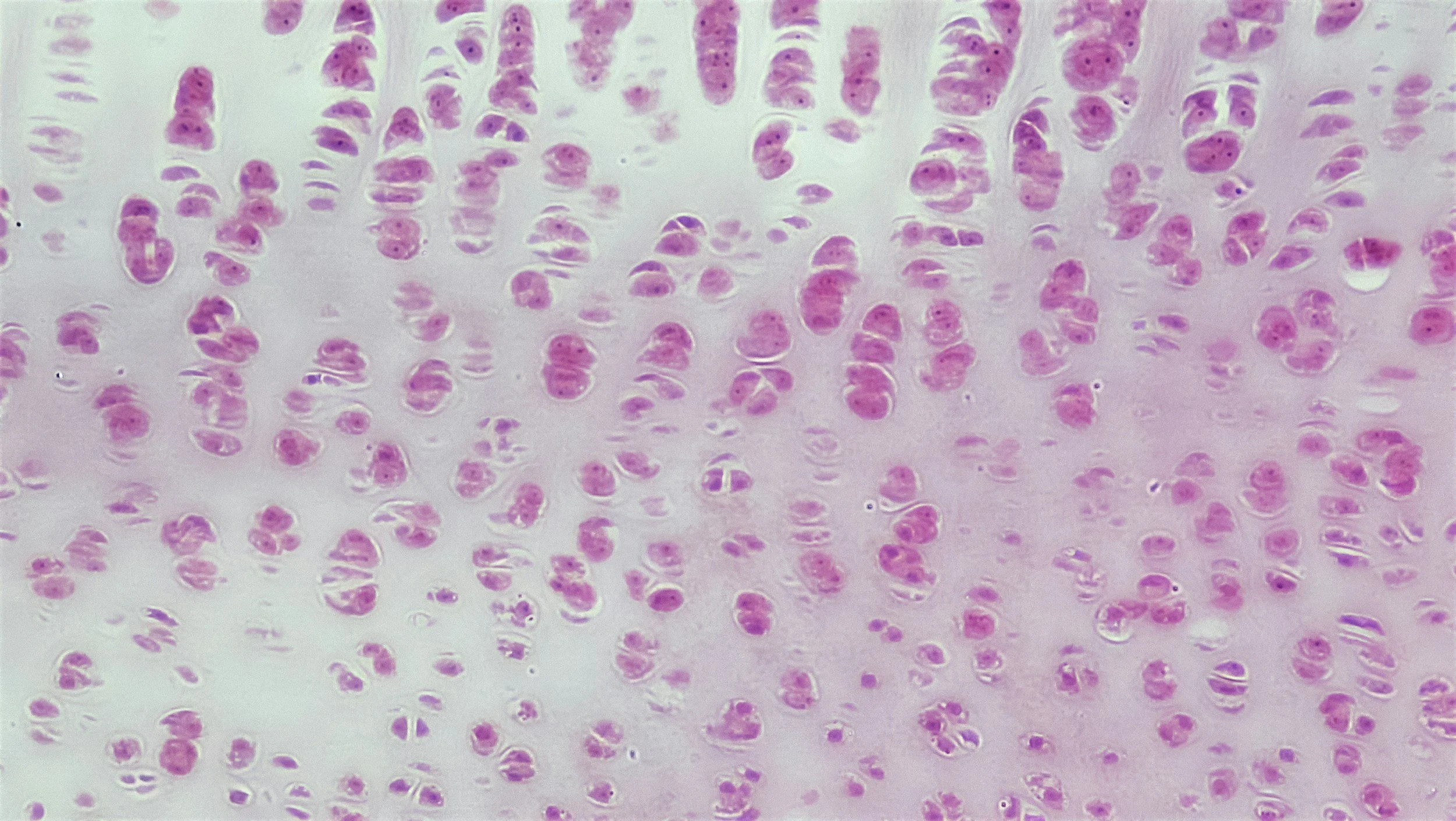 Does Cartilage Grow Back? Evidence For and Against