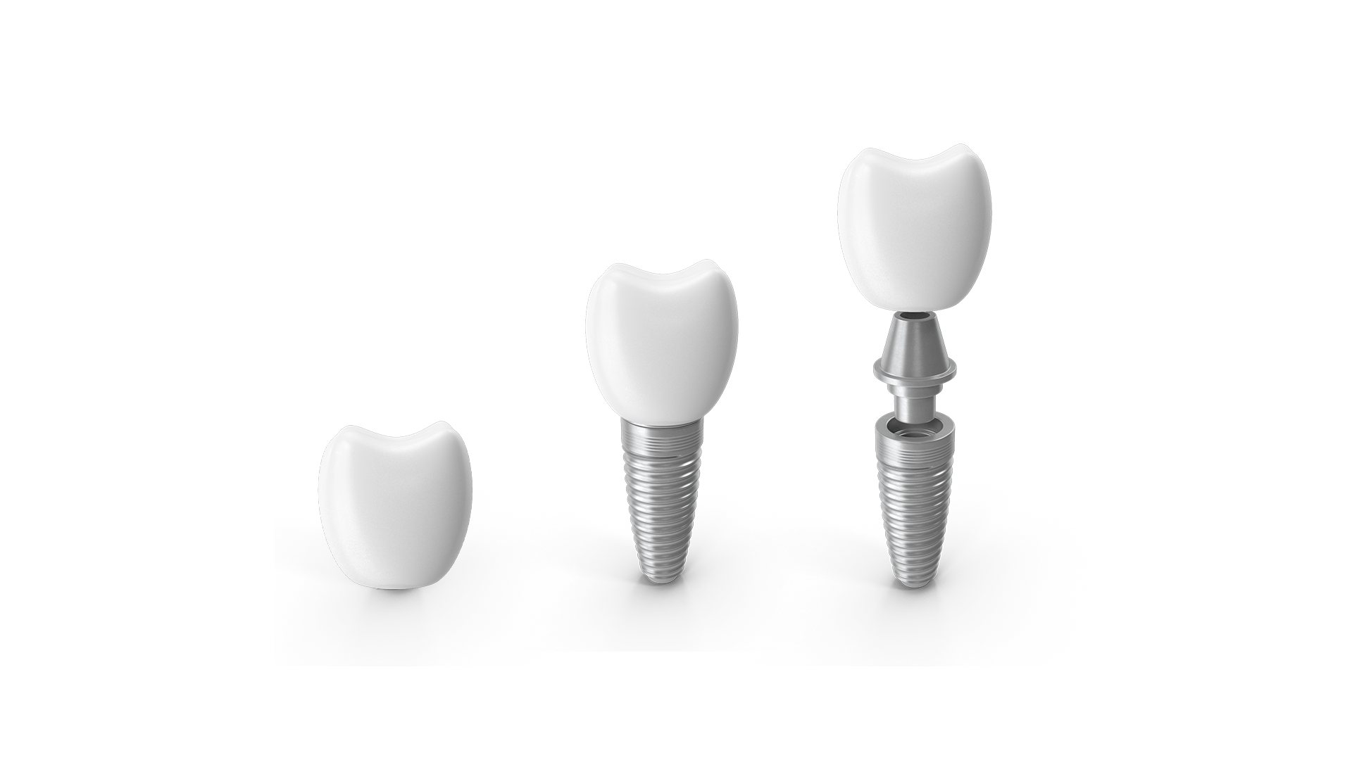 Single & multiple implants — Rock Solid Implants & Dentures