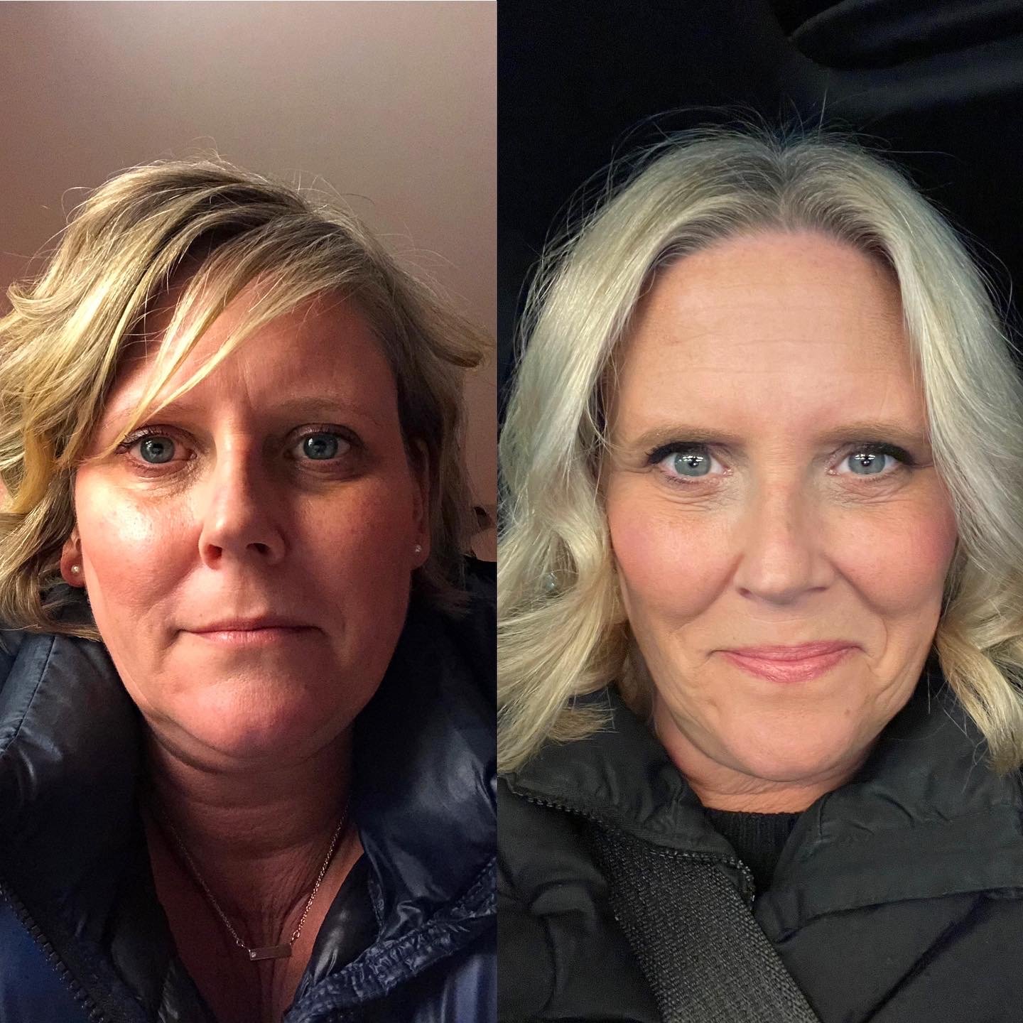 Weight Loss and Not Drinking