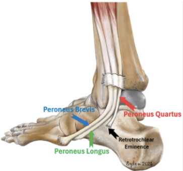 peroneal-rehabilitation