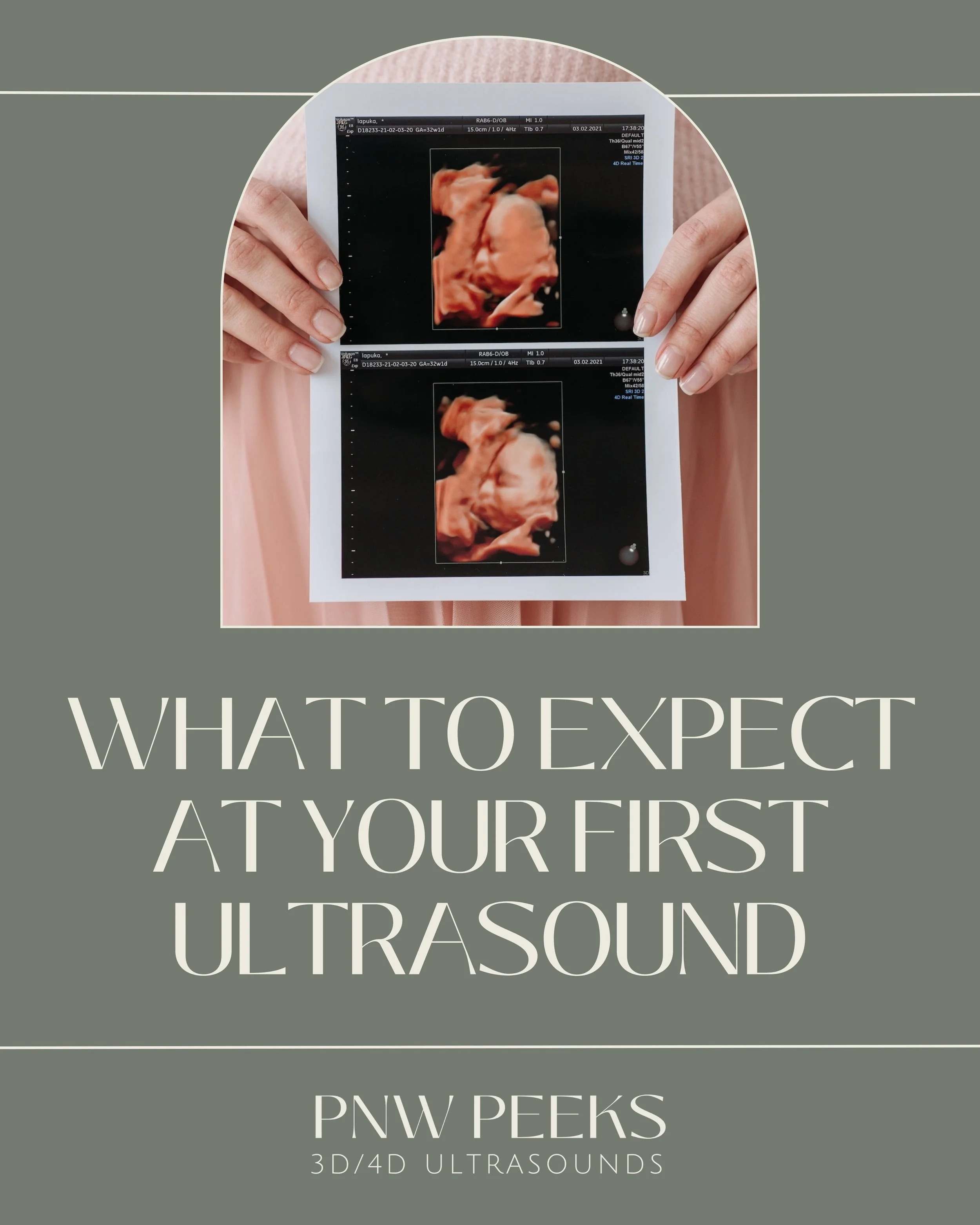Holding ultrasound images of a fetus with a message about expecting a first ultrasound.