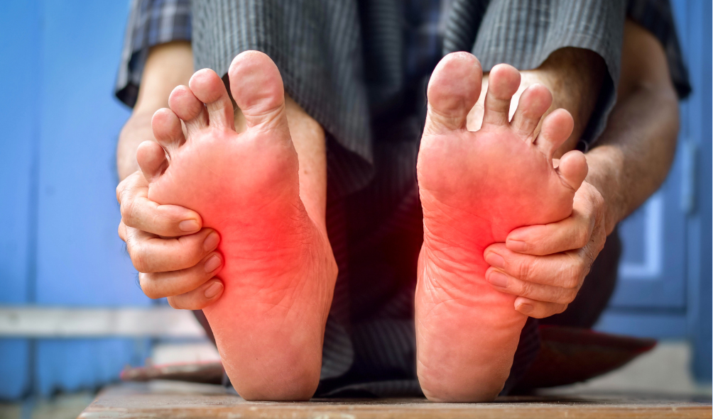 Acupuncture for Neuropathy