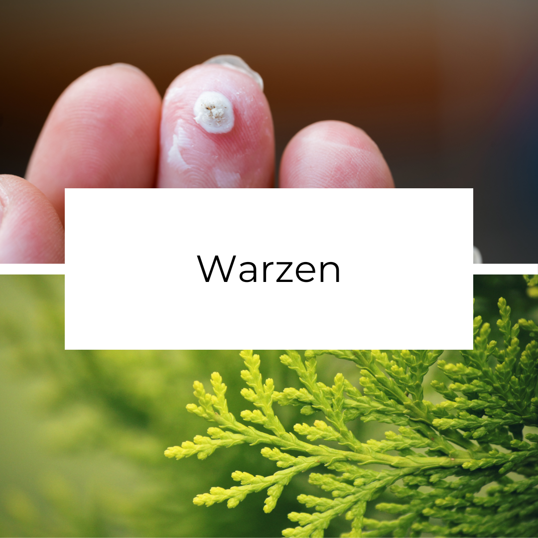 Warzen.png