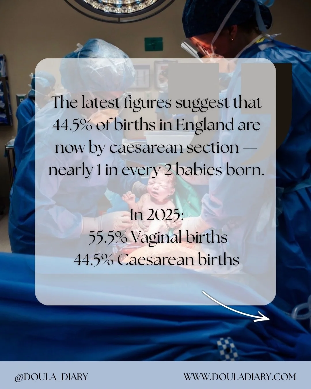 Did you know?

The latest figures suggest that almost 1 in every 2 babies born in England is now born by caesarean section.

In 2025:
🤱 55.5% of births were vaginal
🏥 44.5% were by caesarean
📅 20.4% were planned caesareans
🚨 24.1% were emergency 