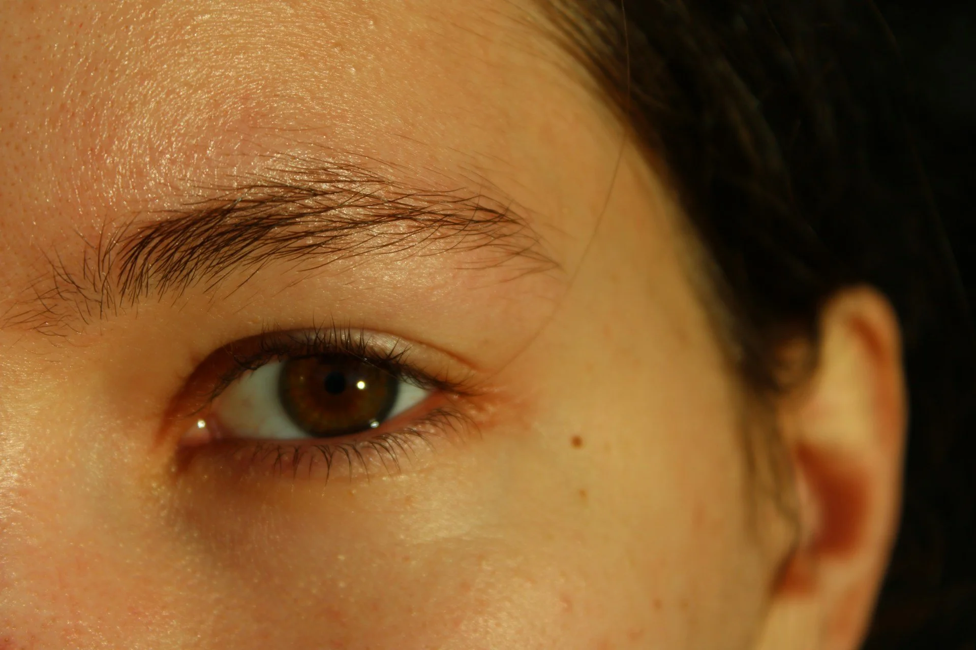Addressing Temporary Swelling After Treatments