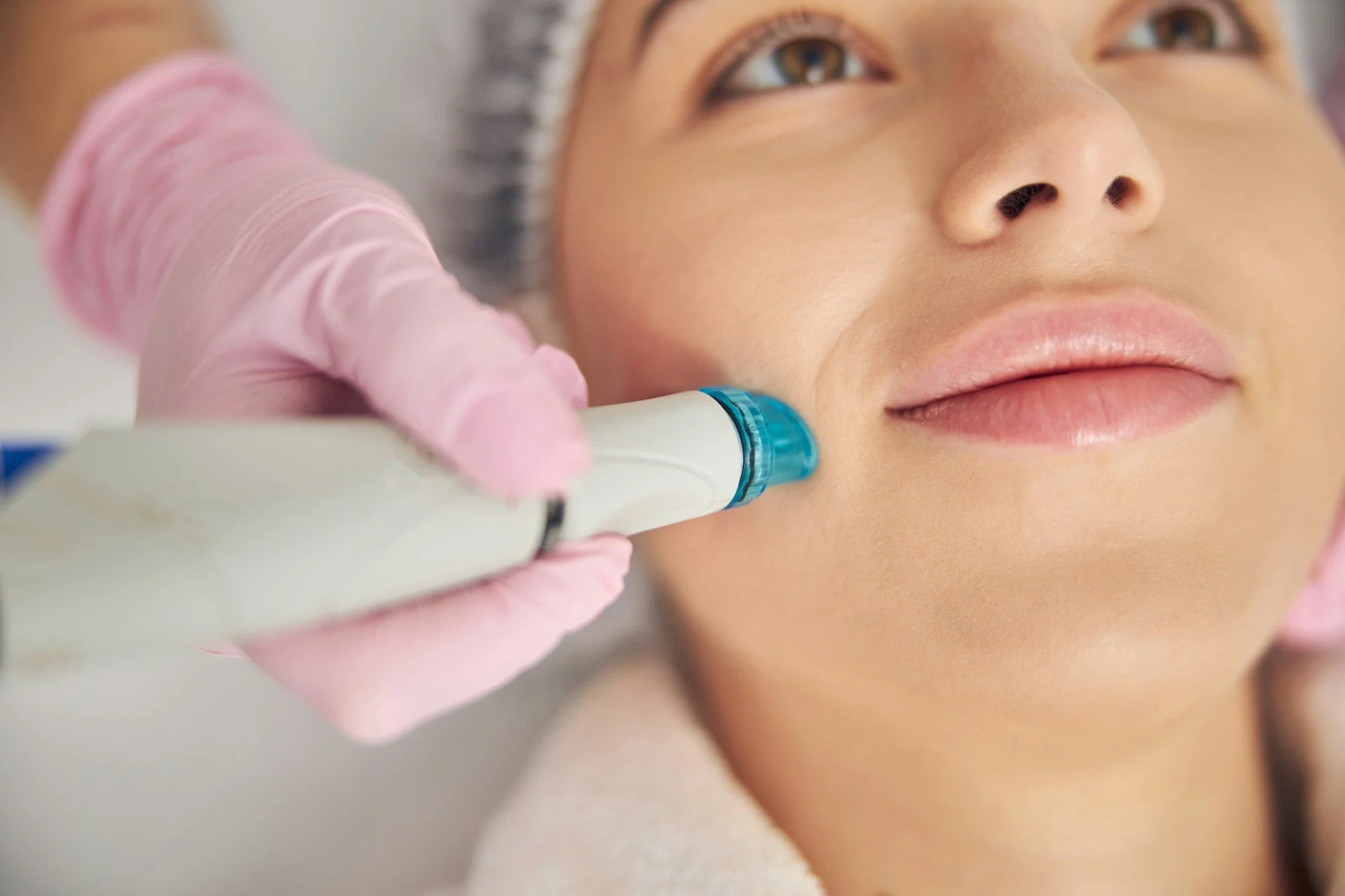 Unlocking Skin Needling Treatment for Pore and Scar Refinement