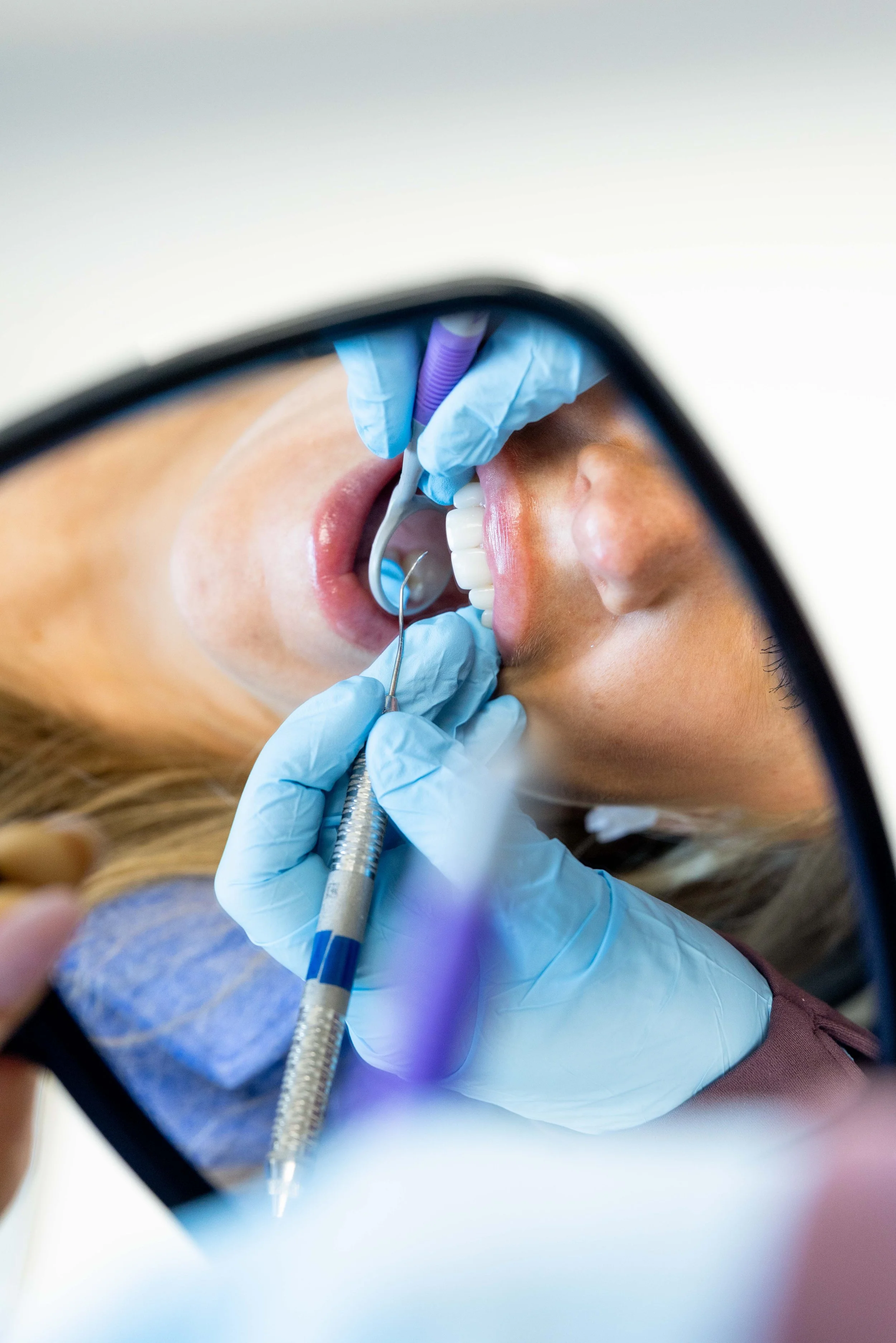 A person with light skin getting dental care, reflected in a mirror, with a dentist wearing blue gloves using dental instruments.