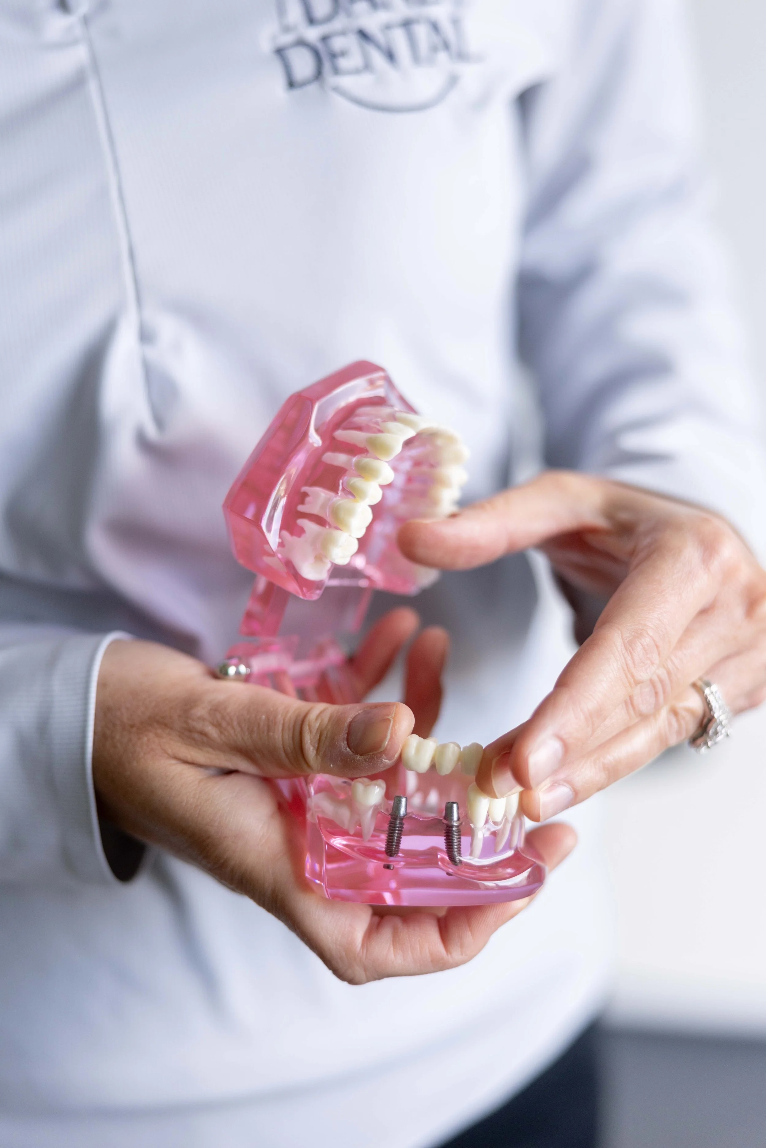 Person in white dental uniform holding a pink dental model with artificial teeth, demonstrating dental implants.