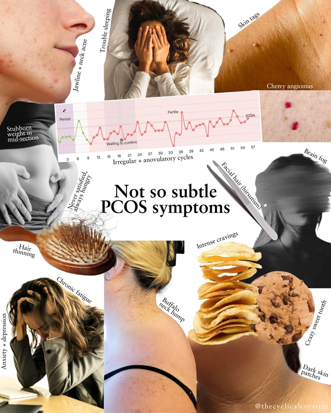 💬 Comment &ldquo;PCOS&rdquo; and I&rsquo;ll send you my one-stop-shop PCOS Survival Guide

PCOS is often reduced to its name, but polycystic ovary syndrome is far more than an ovarian condition&hellip;

It&rsquo;s a whole-body metabolic and hormonal