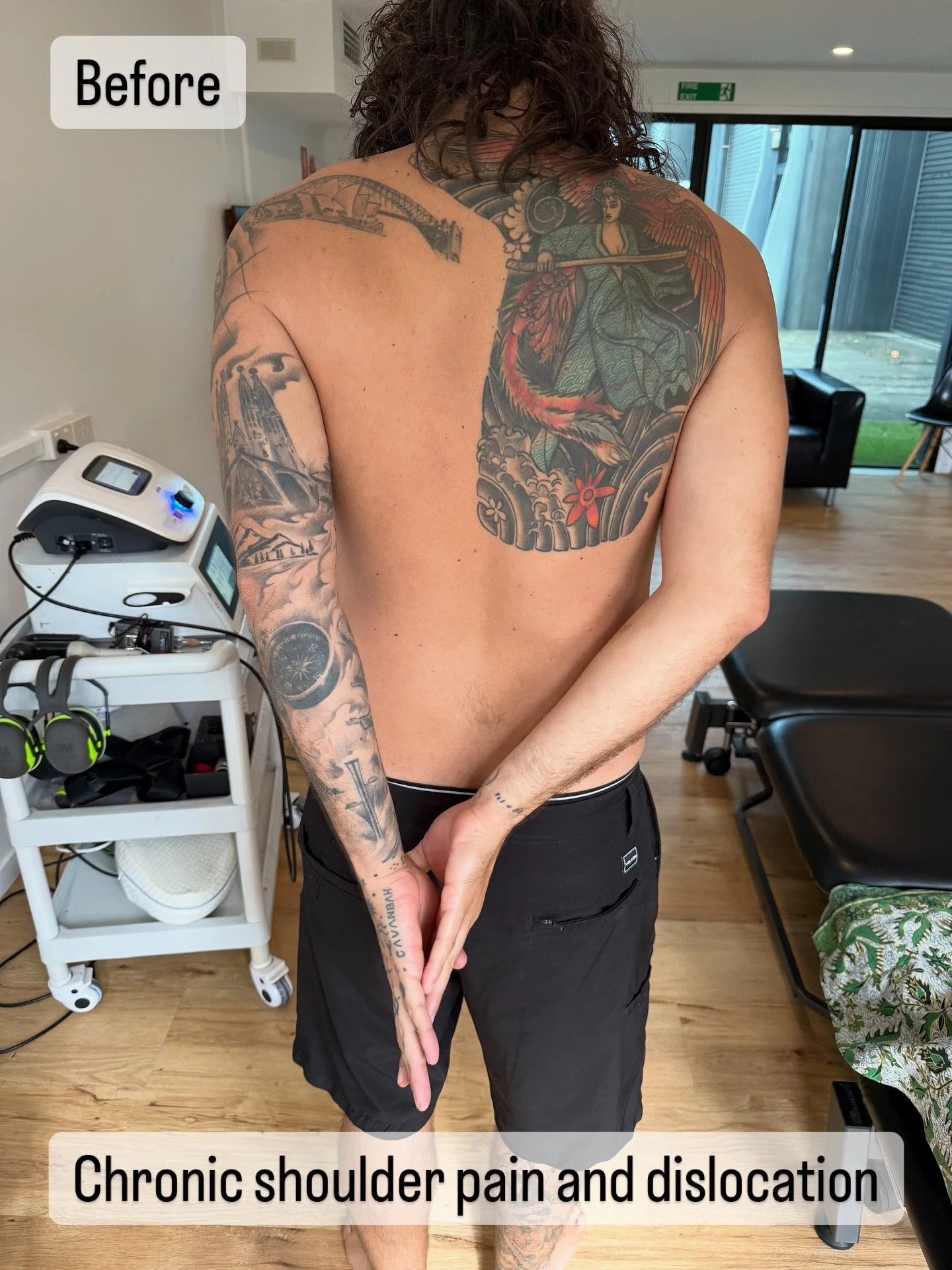 THE DIFFERENCE 10 minutes of treatment can make!!!
We love what we do and when you win we win. Using advanced therapies like Shockwave and Photobiomodulation (laser) you can get instant relief. These therapies are no longer for high performance athle