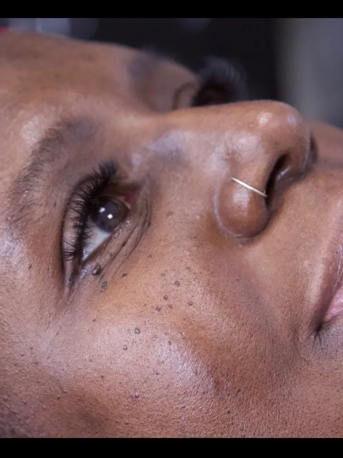 Close-up of a woman's face focusing on her left eye and nose, with some small skin blemishes visible.
