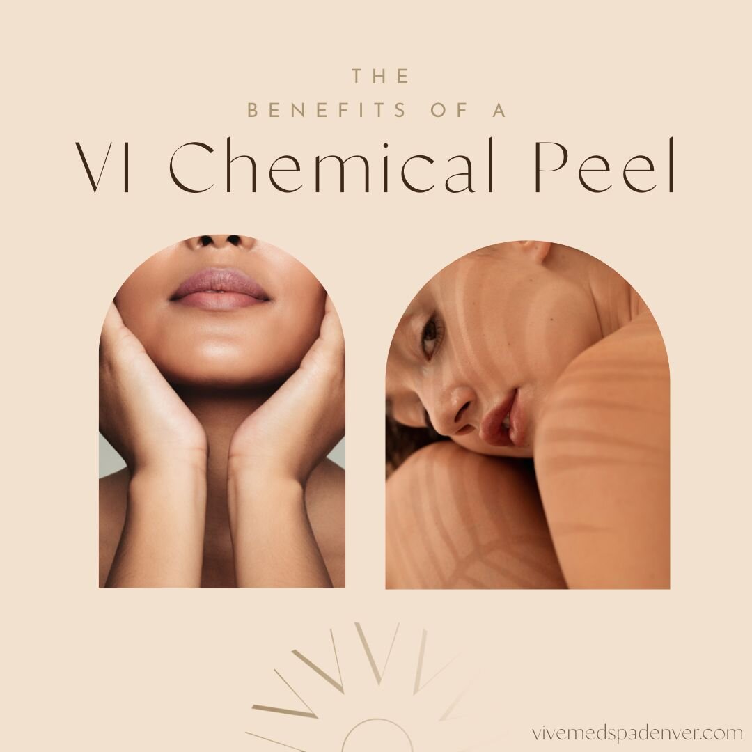 A VI Peel is a type of chemical peel that goes to medium depth, penetrating the epidermis to reach the dermis below. Like other types of chemical peels, a VI Peel stimulates new cell production while exfoliating the skin. 

So, what does this mean in