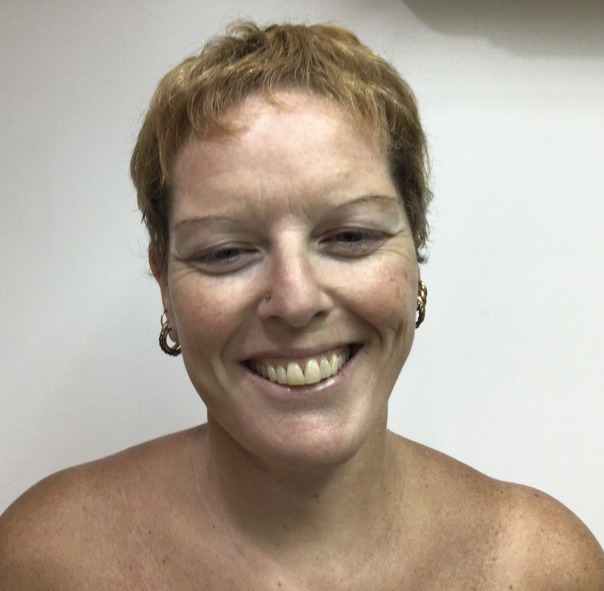 Meet Lee - And a look into her surgery package in Bangkok, Thailand