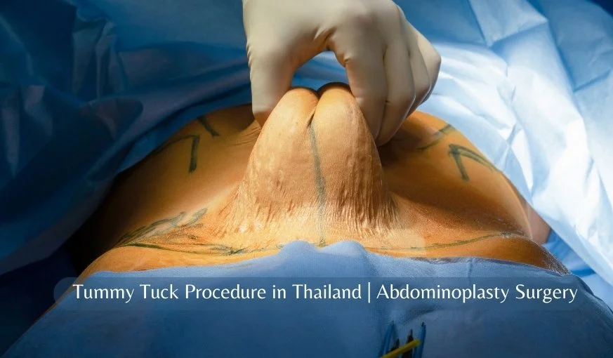 Tummy Tuck Procedure in Thailand | Abdominoplasty Surgery