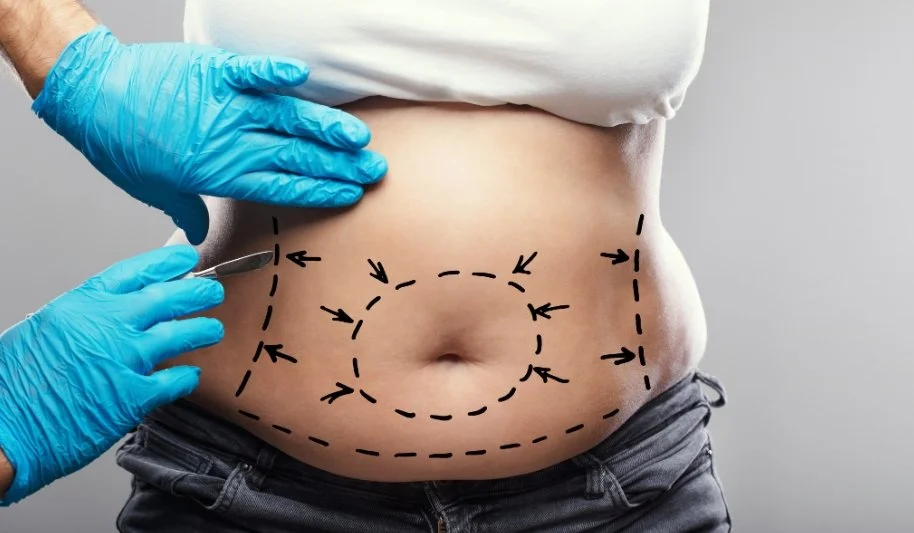 Liposuction Surgery in Thailand | Packages, Cost And More