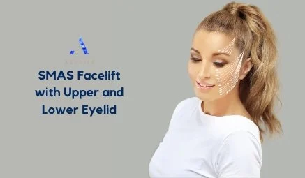 SMAS Facelift with Upper and Lower Eyelid Enhancement