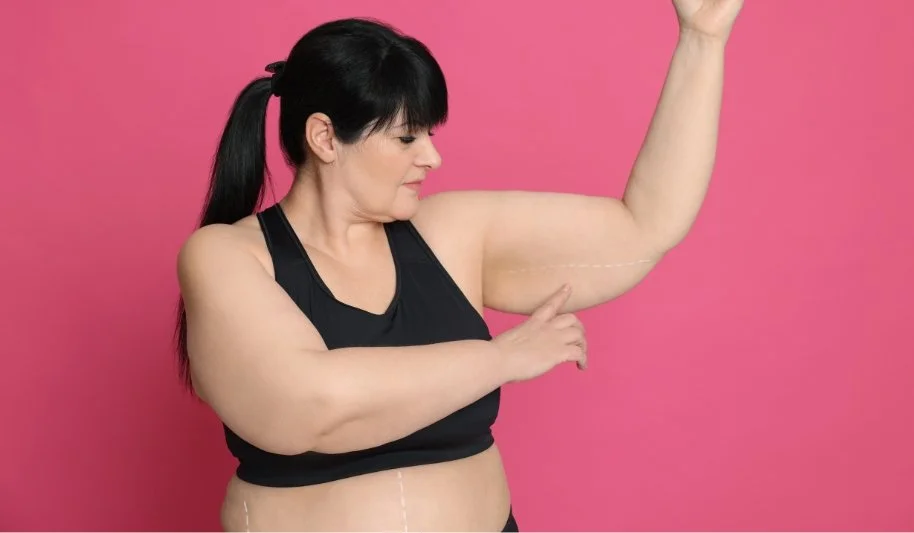 Arm Liposuction Before And After - Overview